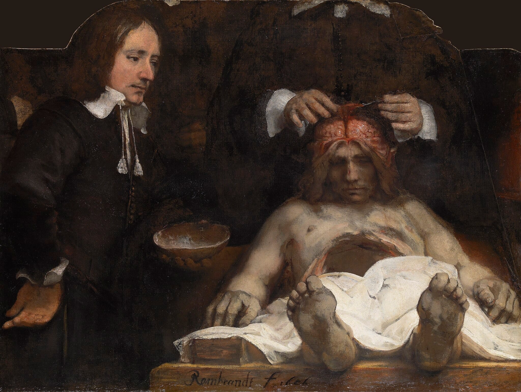 The Anatomy Lesson of Dr. Jan Deijman